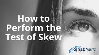 How to Perform the Test of Skew for Vertigo [upl. by Doralin]