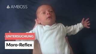 MoroReflex  Frühkindliche Reflexe  AMBOSS Video [upl. by Savell]