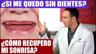 SI ME QUEDO SIN DIENTES ¿QUÉ OPCIONES TENGO PARA SONREIR Y MASTICAR DE NUEVO  Dentadura implantes [upl. by Nytsirt383]