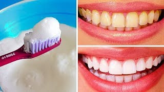 10 formas naturales de blanquear los dientes amarillentos en casa [upl. by Eba]