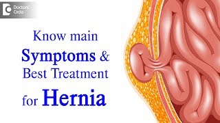 What is Hernia Symptoms Causes Types Treatment  Dr Harish N S  Doctors Circle [upl. by Newnorb]